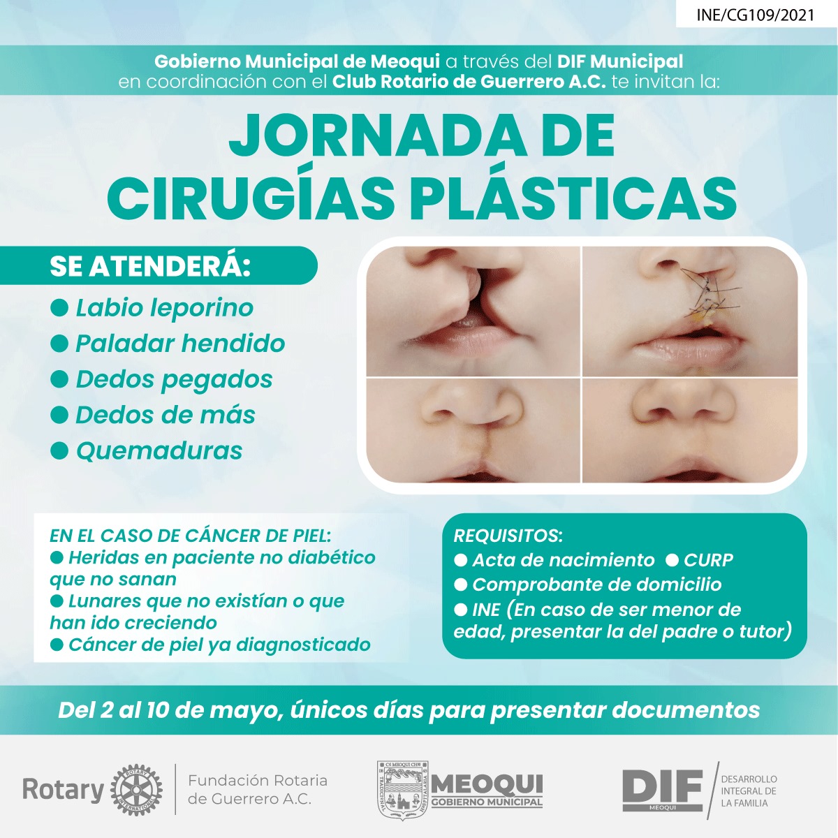 Abierta la recepción de documentos en DIF Meoqui para Jornada de Cirugías Plásticas