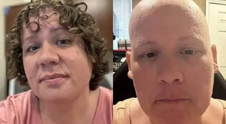 Mujer se sometió a quimioterapias y descubrió que nunca tuvo ¡cáncer!