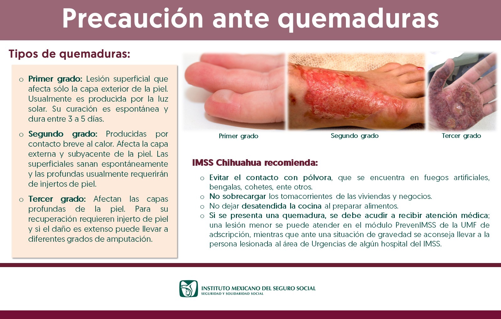 Advierte IMSS Chihuahua sobre quemaduras principalmente por fuegos artificiales